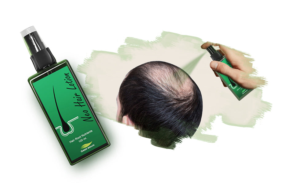 3) Spray Green Wealth Neo Hair Lotion